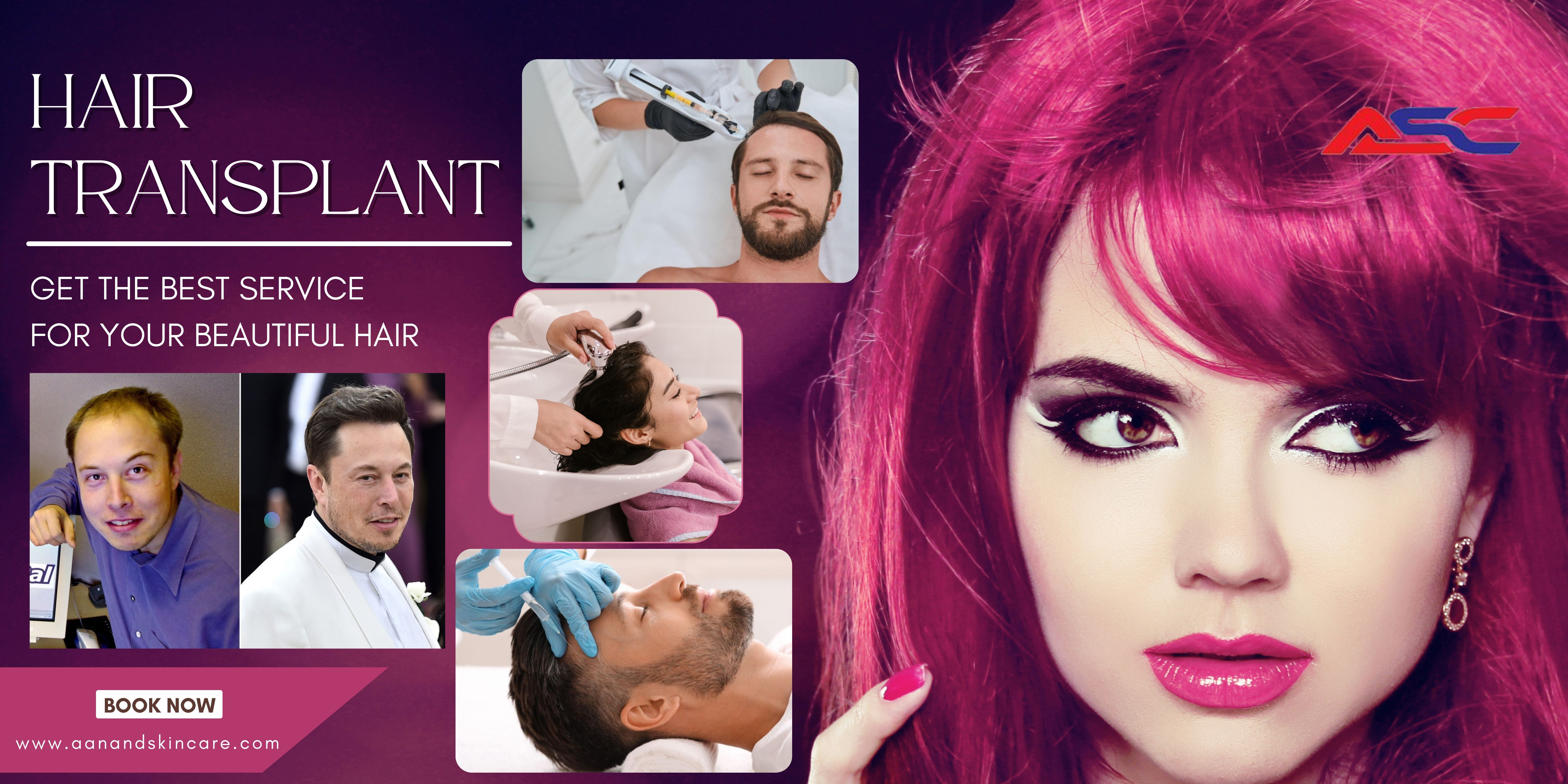 Hair Transplant in Adampur
