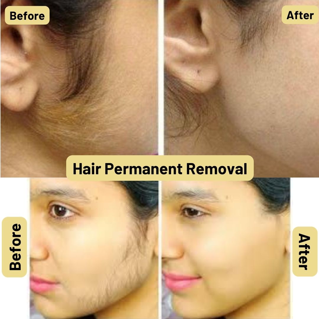 Treatment For Bad Nails In Adampur