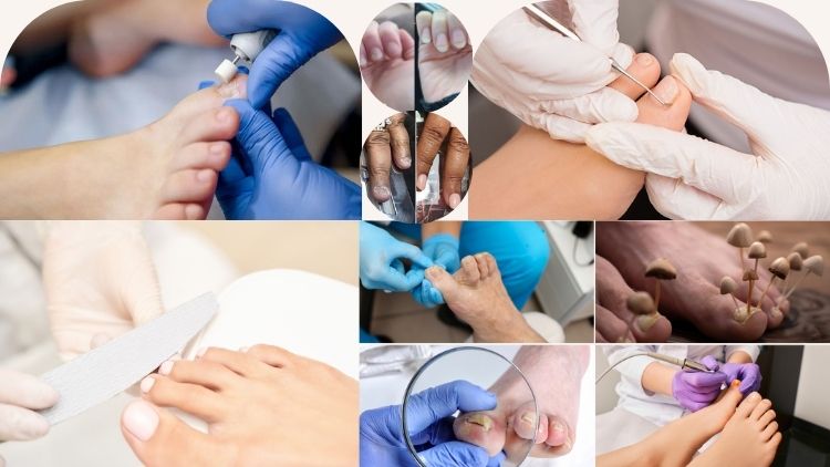 Treatment For Bad Nails in Adampur